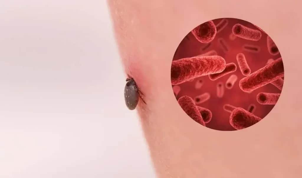 Skuteczne sposoby na pozbycie się kleszczy z działki i ochronę zdrowia